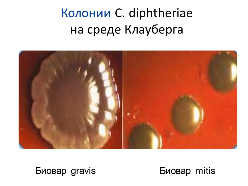 Колонии C. diphtheriae  на среде Клауберга Биовар gravis   Биовар mitis